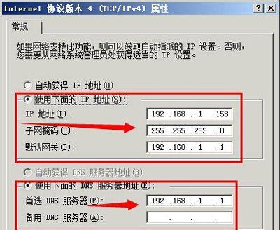 本地连接IP地址设置指南（简单操作让您轻松设置本地连接IP地址）