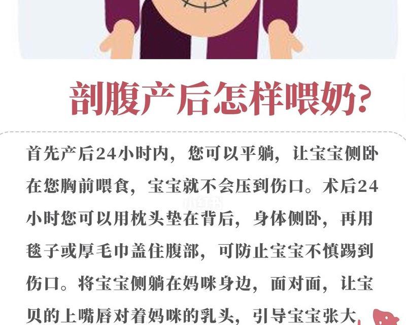 剖腹产注意事项（保护产妇健康的关键措施）